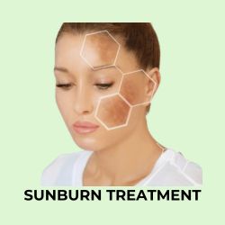 shajkonna sunburn treatment